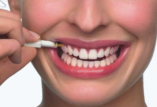 Implante Dentário em Anápolis