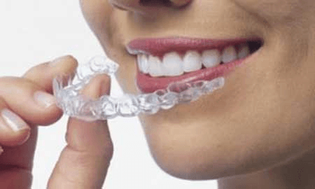 Moldes para Clareamento de Dentes